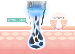 mks美克斯電動毛孔清潔器 告別黑頭粉刺，開啟深層凈澈護膚時代